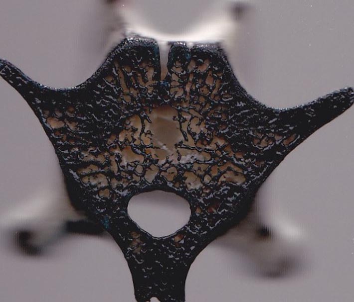 vertebra5